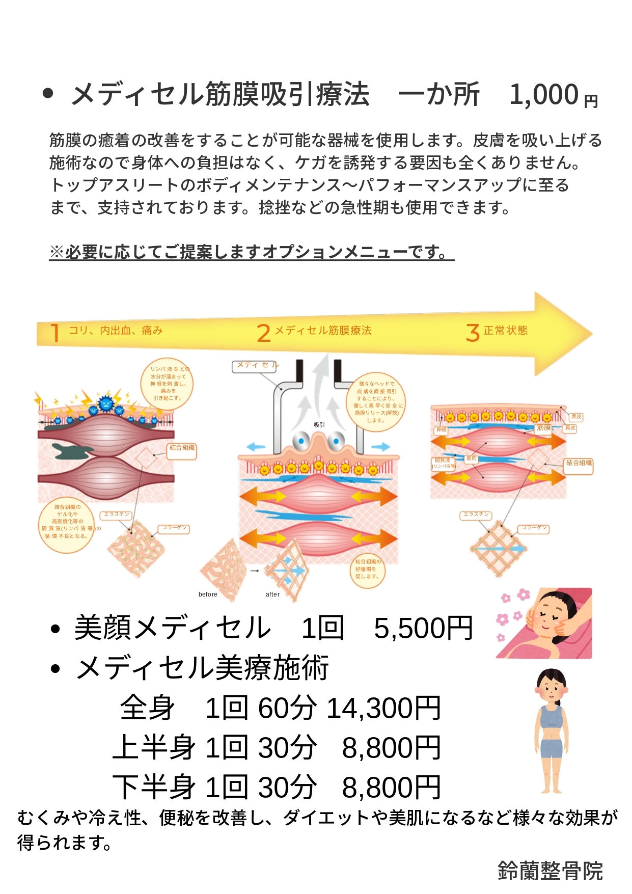 鈴蘭整骨院の自由診療料金表